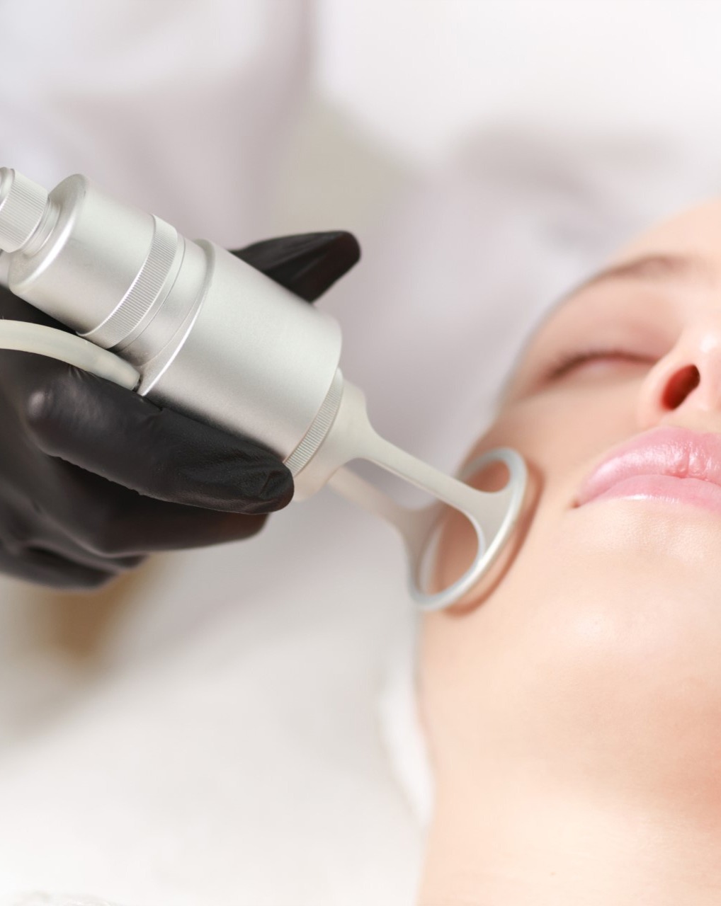 Laser Resurfacing in Trenton Michigan - LTD Aesthetics Wellness
