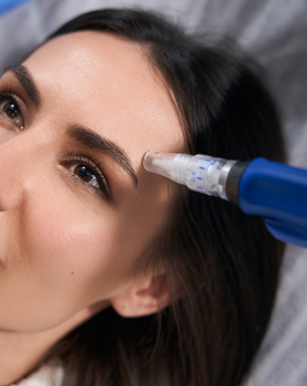 Microneedling in Trenton Michigan - LTD Aesthetics Wellness
